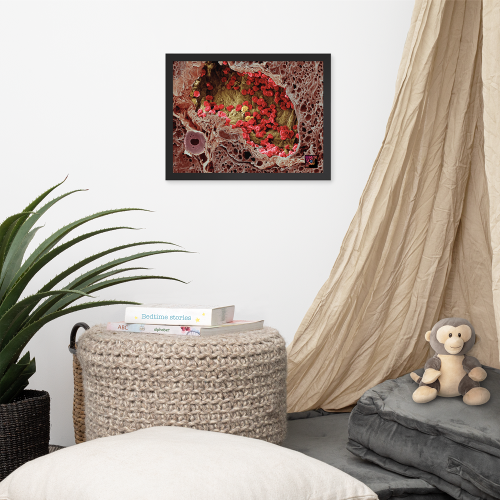 Painting - A blood vessel