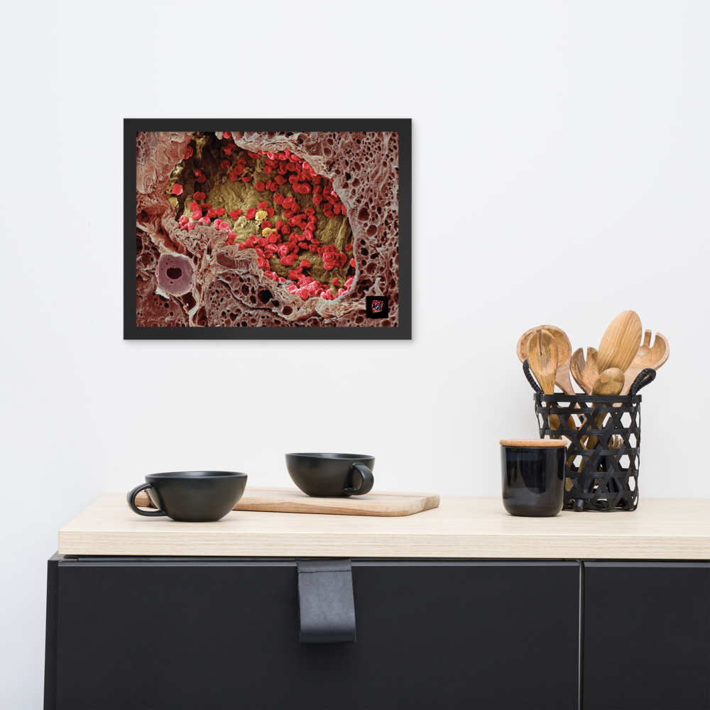 Painting - A blood vessel