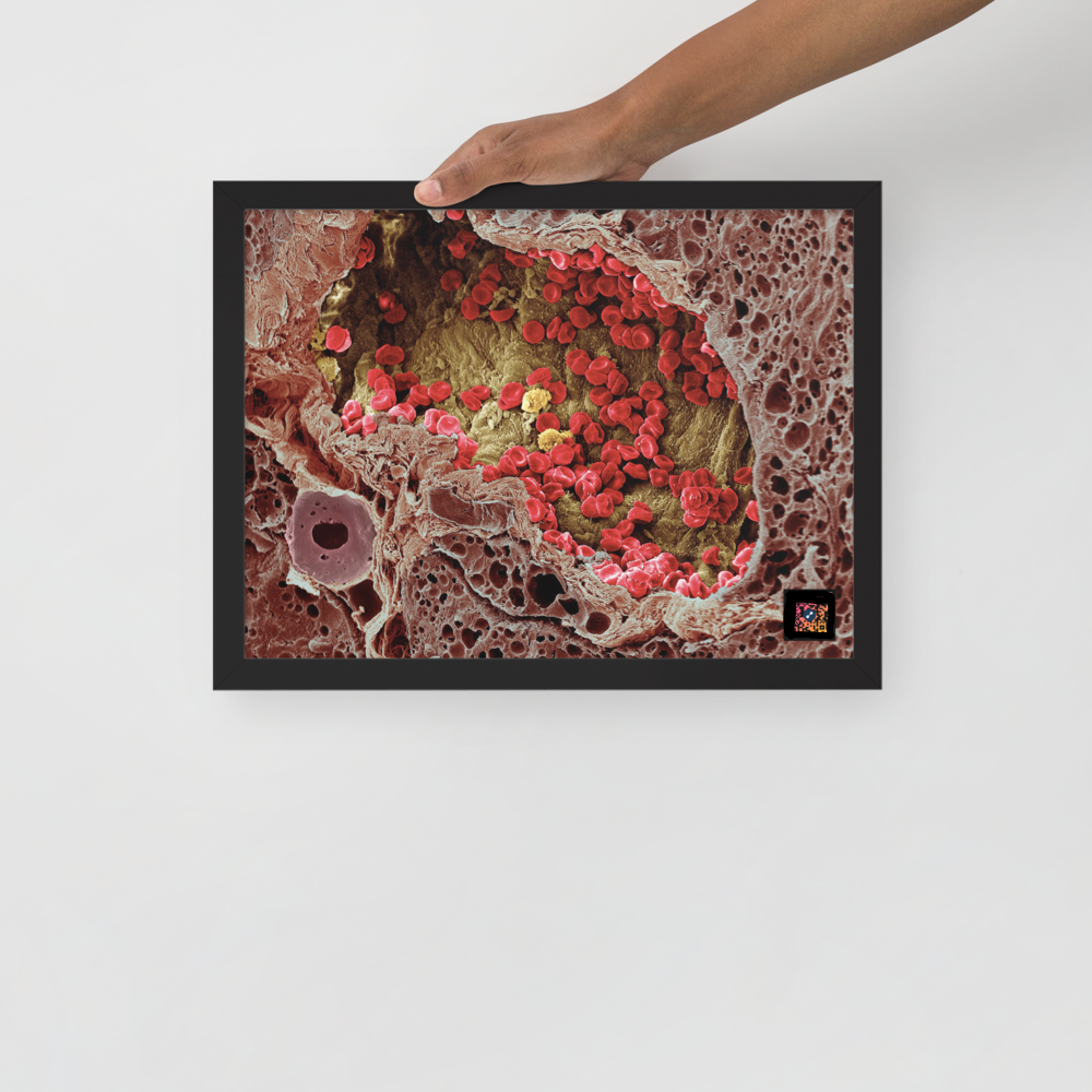 Painting - A blood vessel