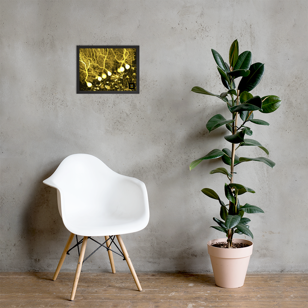 Table - Brain trees
