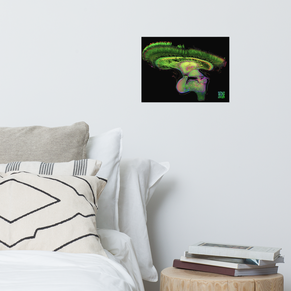 Poster - The Brain of Mantis Shrimp