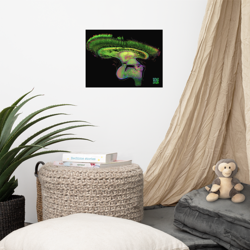 Poster - The Brain of Mantis Shrimp