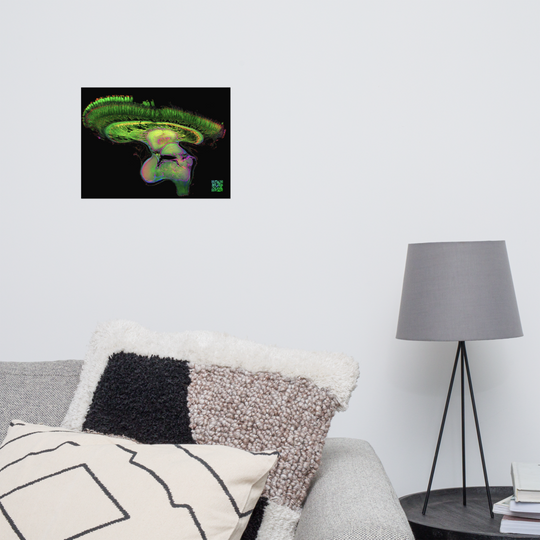 Poster - The Brain of Mantis Shrimp