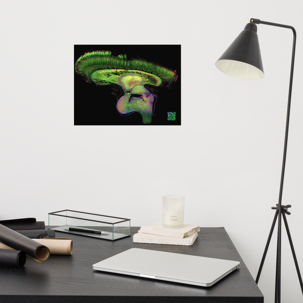 Poster - The Brain of Mantis Shrimp