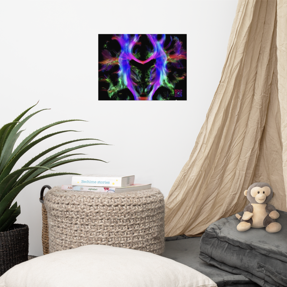 Poster - Fibres cérébrales