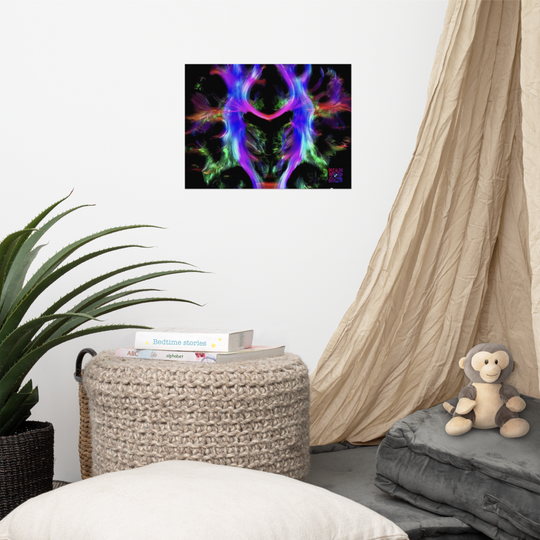 Poster - Fibres cérébrales
