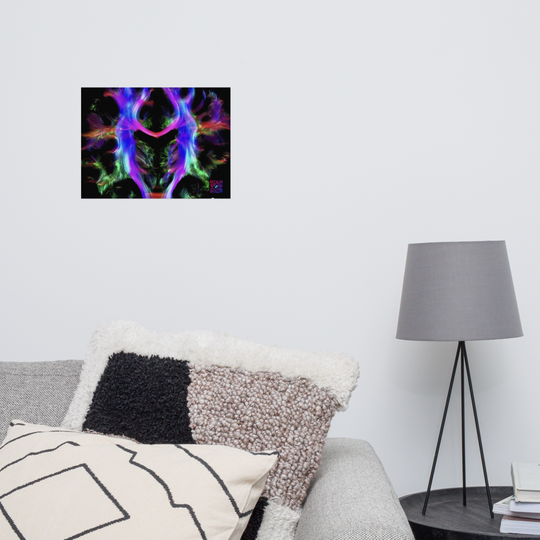 Poster - Fibres cérébrales