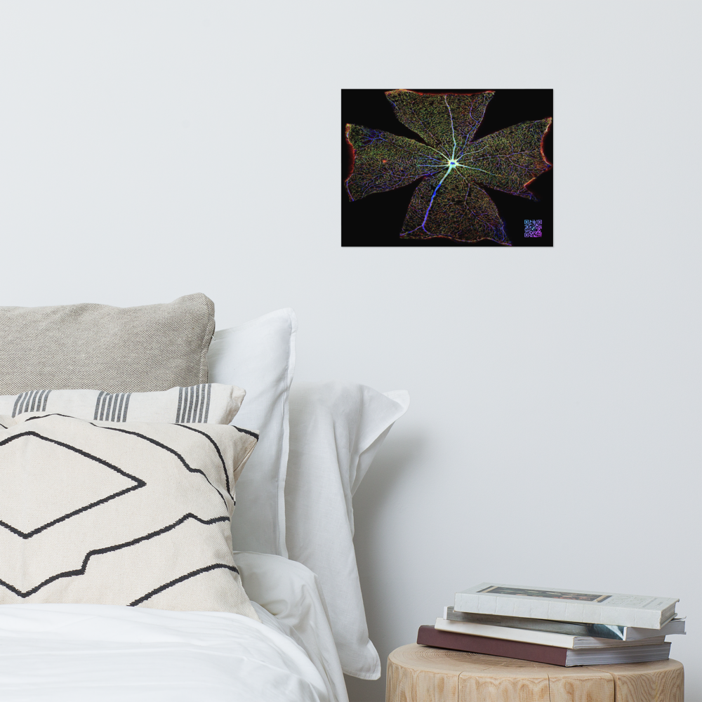 Poster - A view of the retina