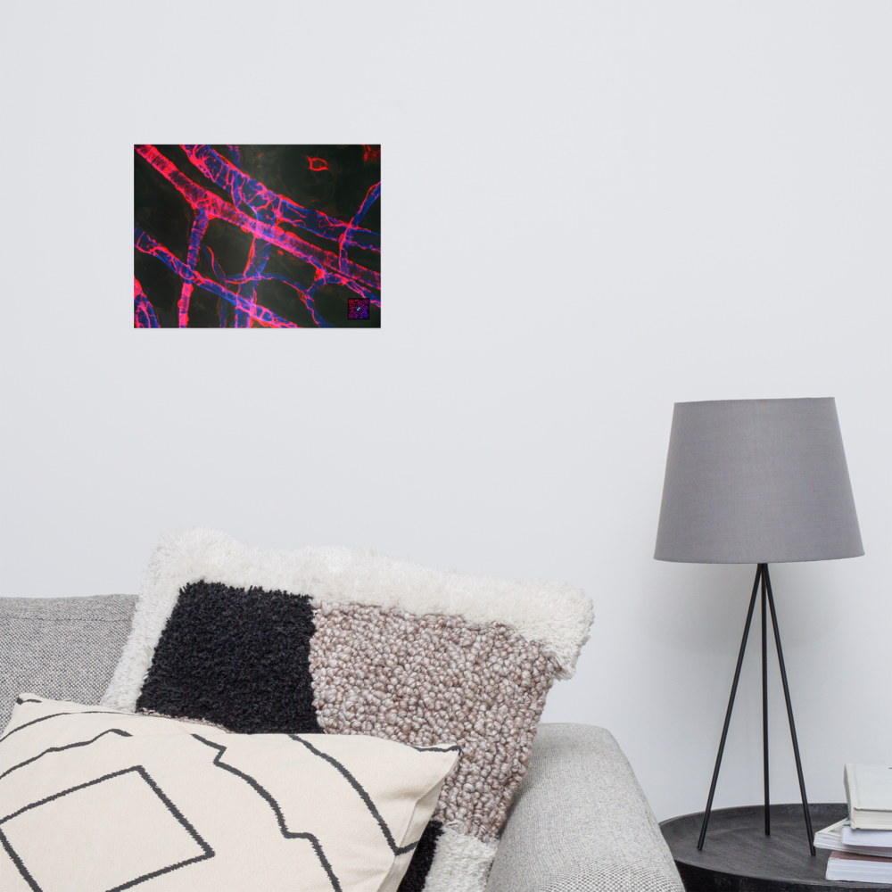 Poster - La vascularisation
