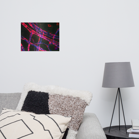 Poster - La vascularisation
