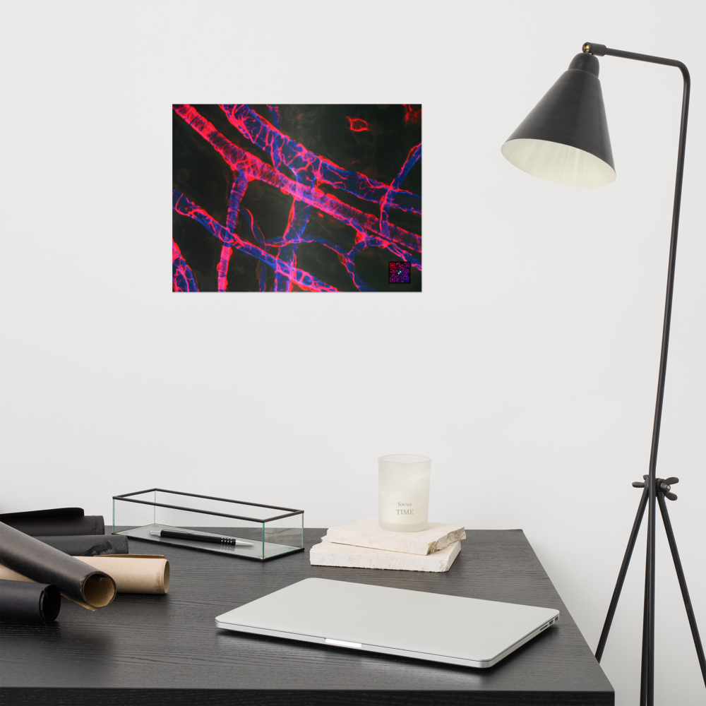 Poster - La vascularisation
