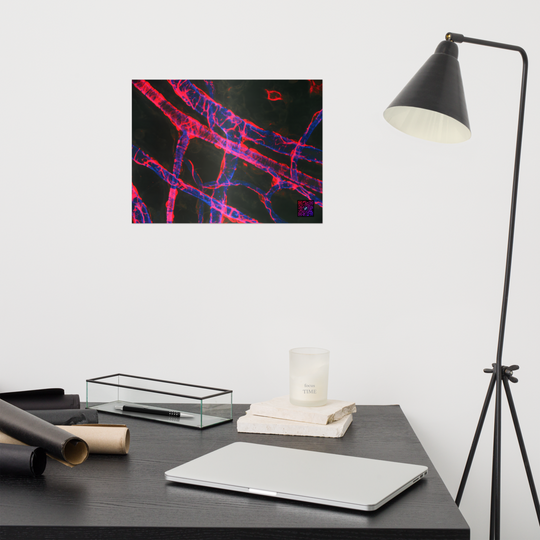 Poster - La vascularisation