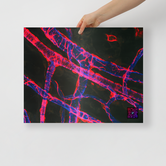 Poster - La vascularisation
